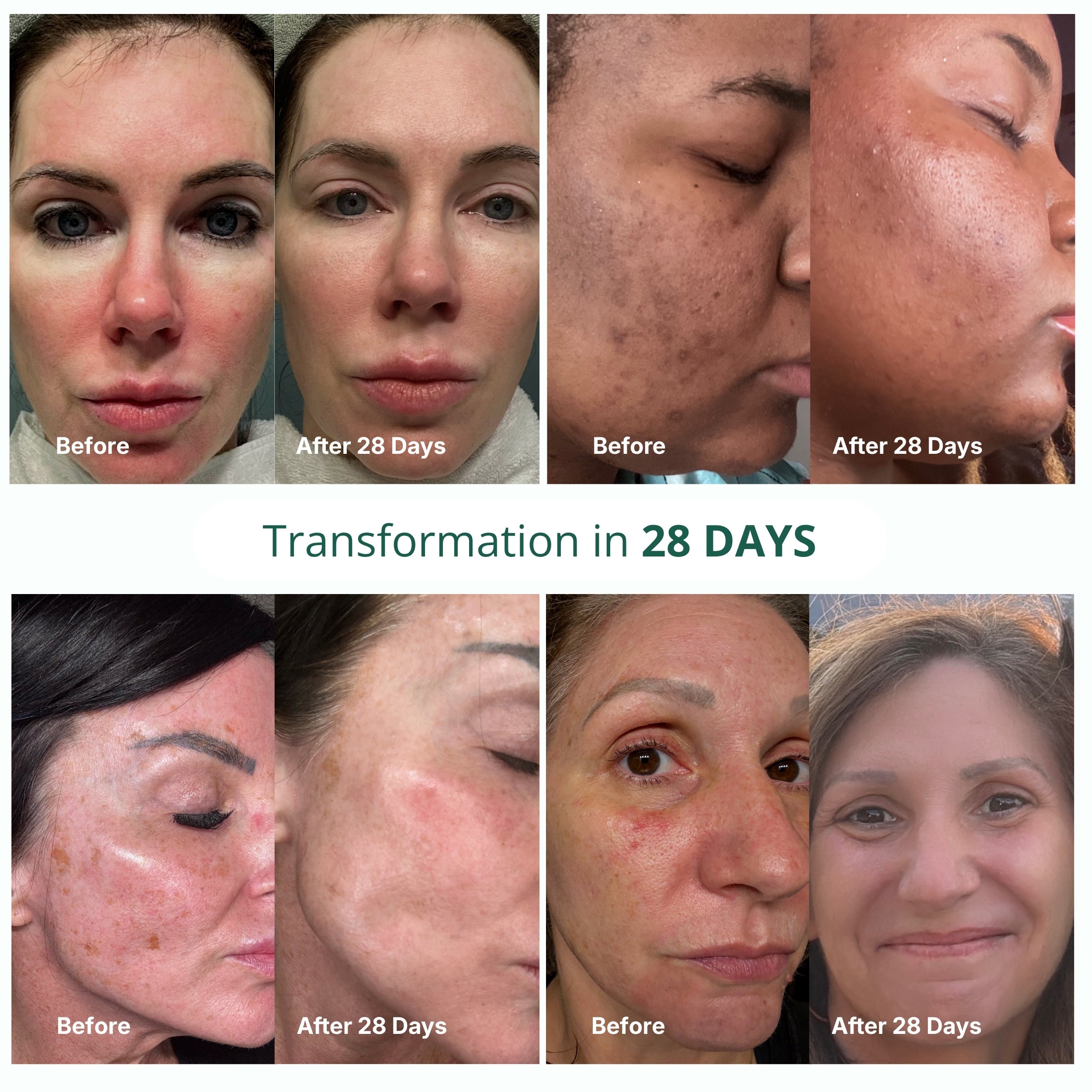 Shoal Sea Cucumber Collagen Rejuvenation Serum