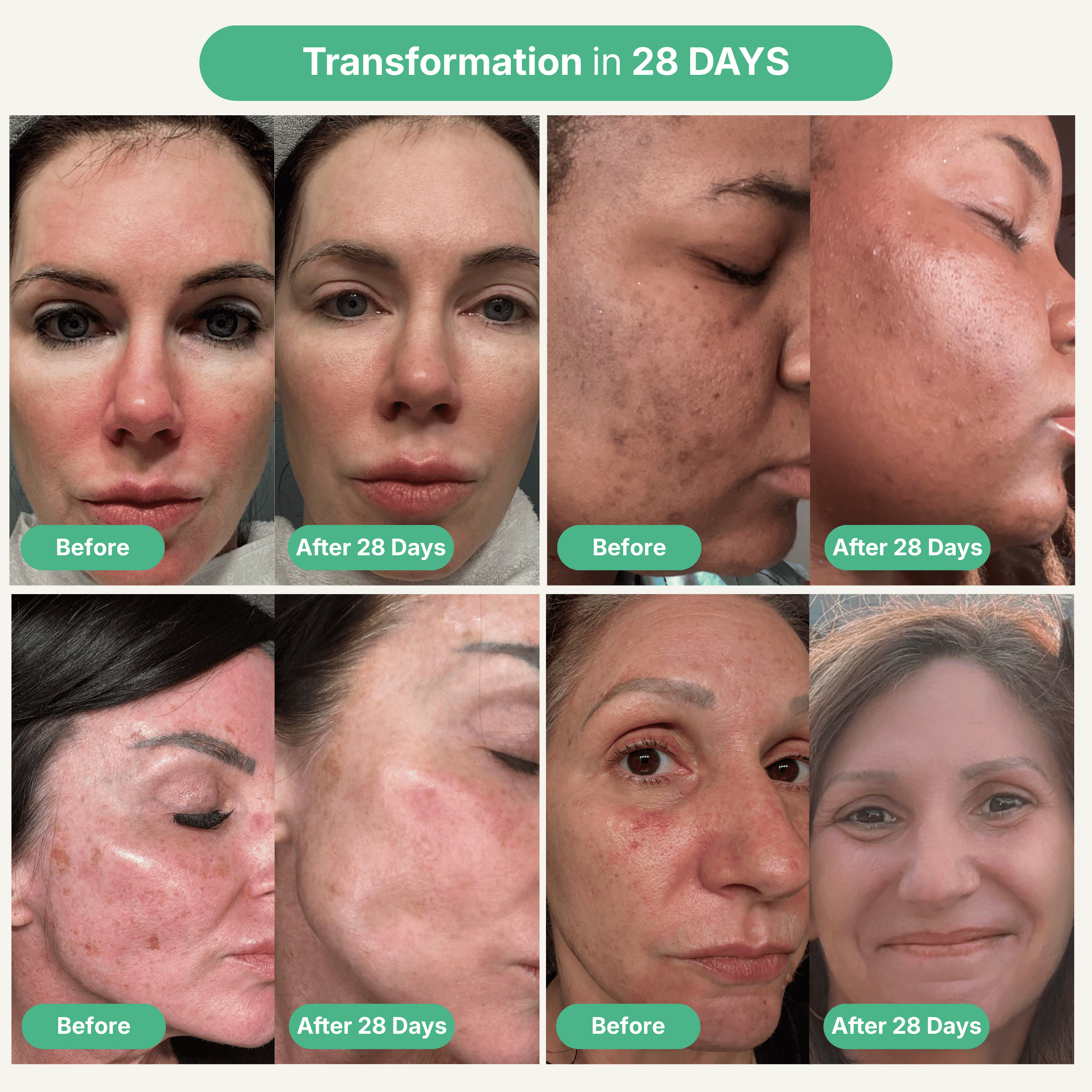 The Shoal Complete Set